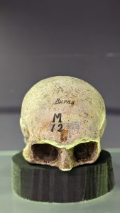Cast of Robert Burns' skull - the front