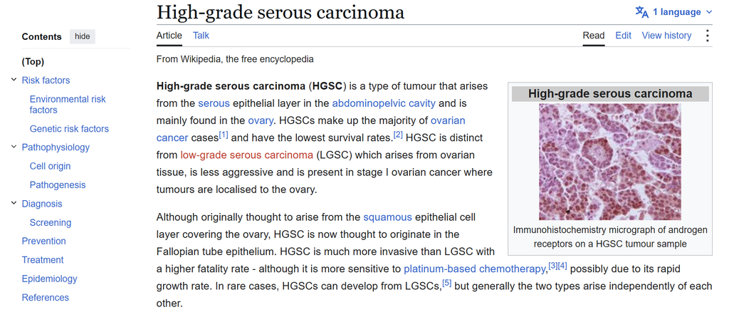 Screengrab for Wikipedia page on High Grade Serous Carcinoma